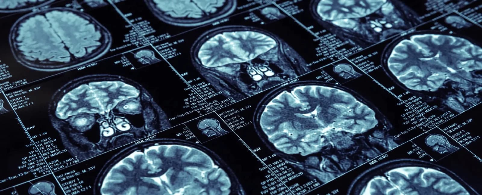 Life Imaging Healthcare Imaging case study — Re-architecting a HIPAA-compliant radiology pipeline processing 10TB of medical imaging data per day